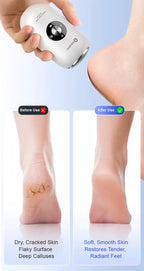 AI 智能無線電動磨腳器